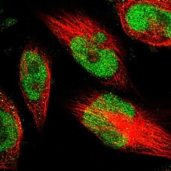 METTL1 Antibody, Novus Biologicals 25 &mu;L | Buy Online | Novus Biologicals | Fisher Scientific